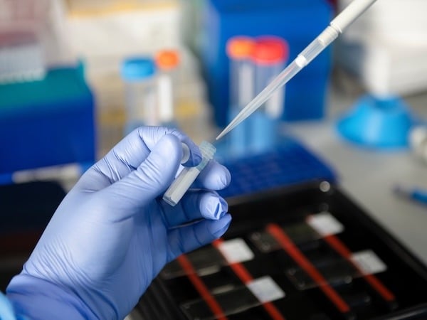 Gloved hands in a laboratory setting holding a small plastic vial while using a pipette to transfer liquid, with lab equipment and test tubes blurred in the background.