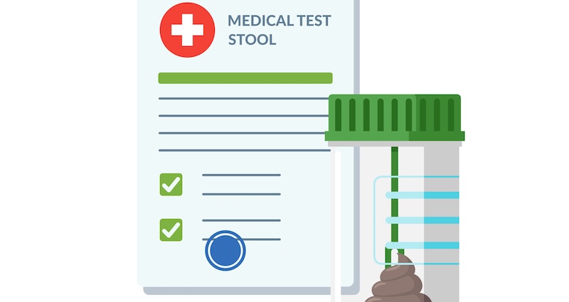 Fecal Swabs: What to Look for in a Fecal Swab Test Kit