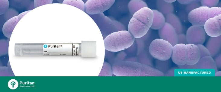 Comparing Sputum Solutions for the Recovery of Respiratory Pathogens